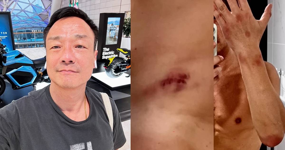 Hong Kong Actor Wong He: Publicly Reveals Two Sexual Assaults In 2024 Hong Kong Actor Wong He: Publicly Reveals Two Sexual Assaults In 2024