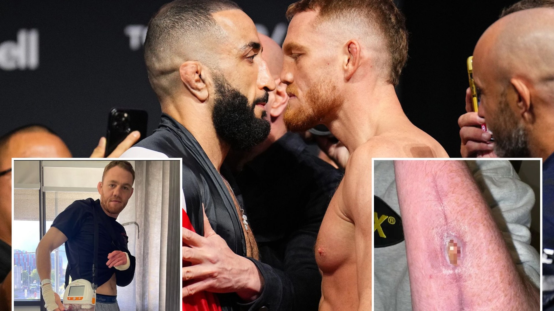 Nine Days In Hospital: How A UFC Fighter Faced A Career-Ending Infection Nine Days In Hospital: How A UFC Fighter Faced A Career-Ending Infection