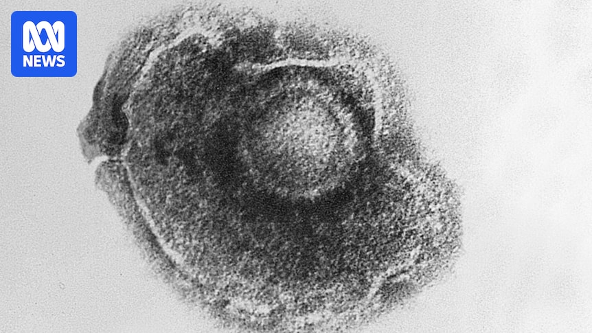 Understanding The Link Between Viruses And Neurodegenerative Diseases Like Dementia Understanding The Link Between Viruses And Neurodegenerative Diseases Like Dementia
